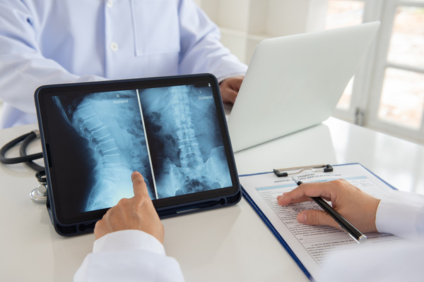 spinal cord injury compensation